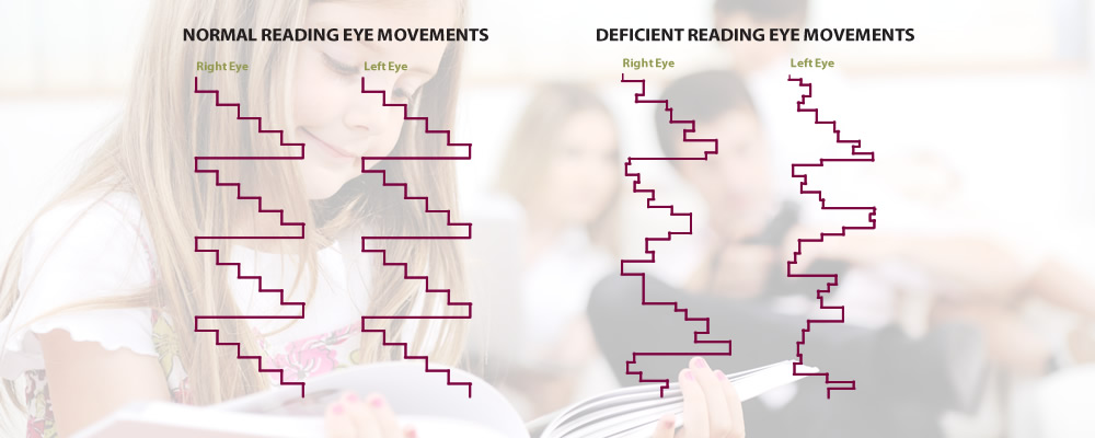 Poor eye tracking skill can make reading and learning difficult Advanced vision Therapy Center Boise Idaho